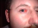 andys evil eye